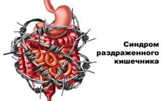 Диете при синдроме раздраженного кишечника