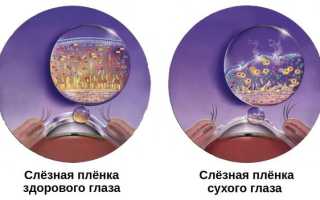 Синдром сухого глаза с фото