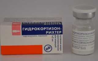 Какие лекарства при туннельном синдроме