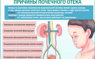 Отечный синдром при заболевании почек