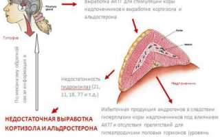 Адреногенетический синдром у новорожденных девочек