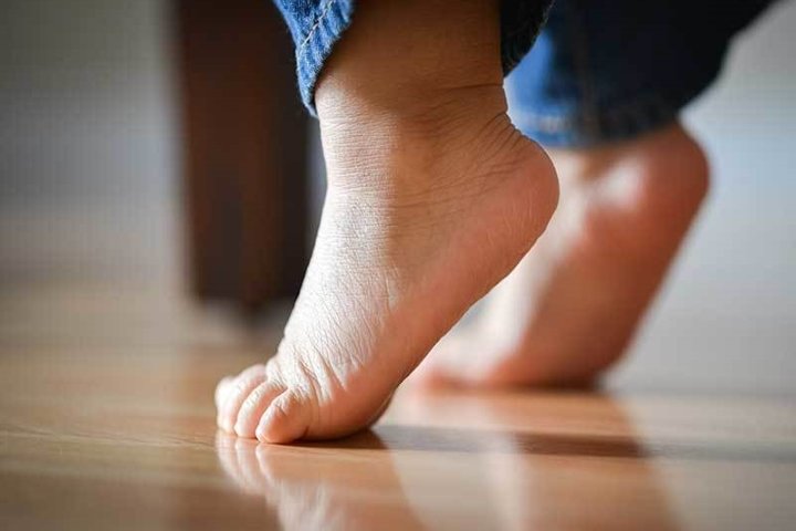 Эквиноварусная деформация стопы код мкб