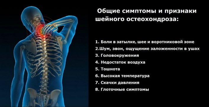 Корешковый синдром при остеохондрозе поясничного отдела
