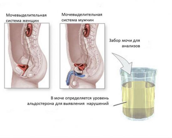 Анализ мочи