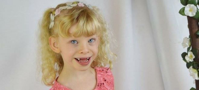 дети эльфы синдром