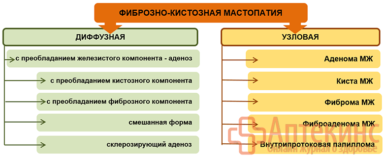 Формы фиброзно-кистозной мастопатии