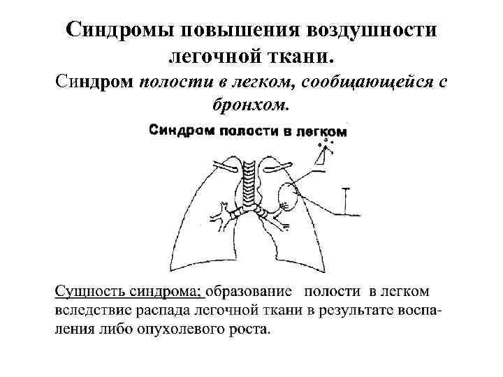 Синдромы повышения воздушности легочной ткани. Синдром полости в легком, сообщающейся с бронхом. 