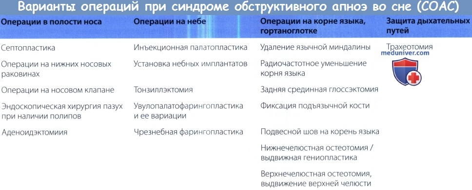Варианты операции при остановке дыхания во сне (синдроме обструктивного апноэ во сне, СОАС)