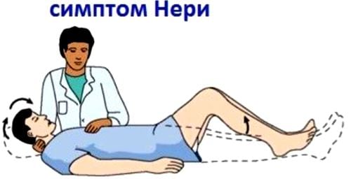Корешковый синдром при остеохондрозе поясничного отдела